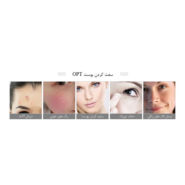 دستگاه Vira IPL SHR OPT مدل SPA728 | دستگاه IPL SHR OPT ویرا مدل SPA728